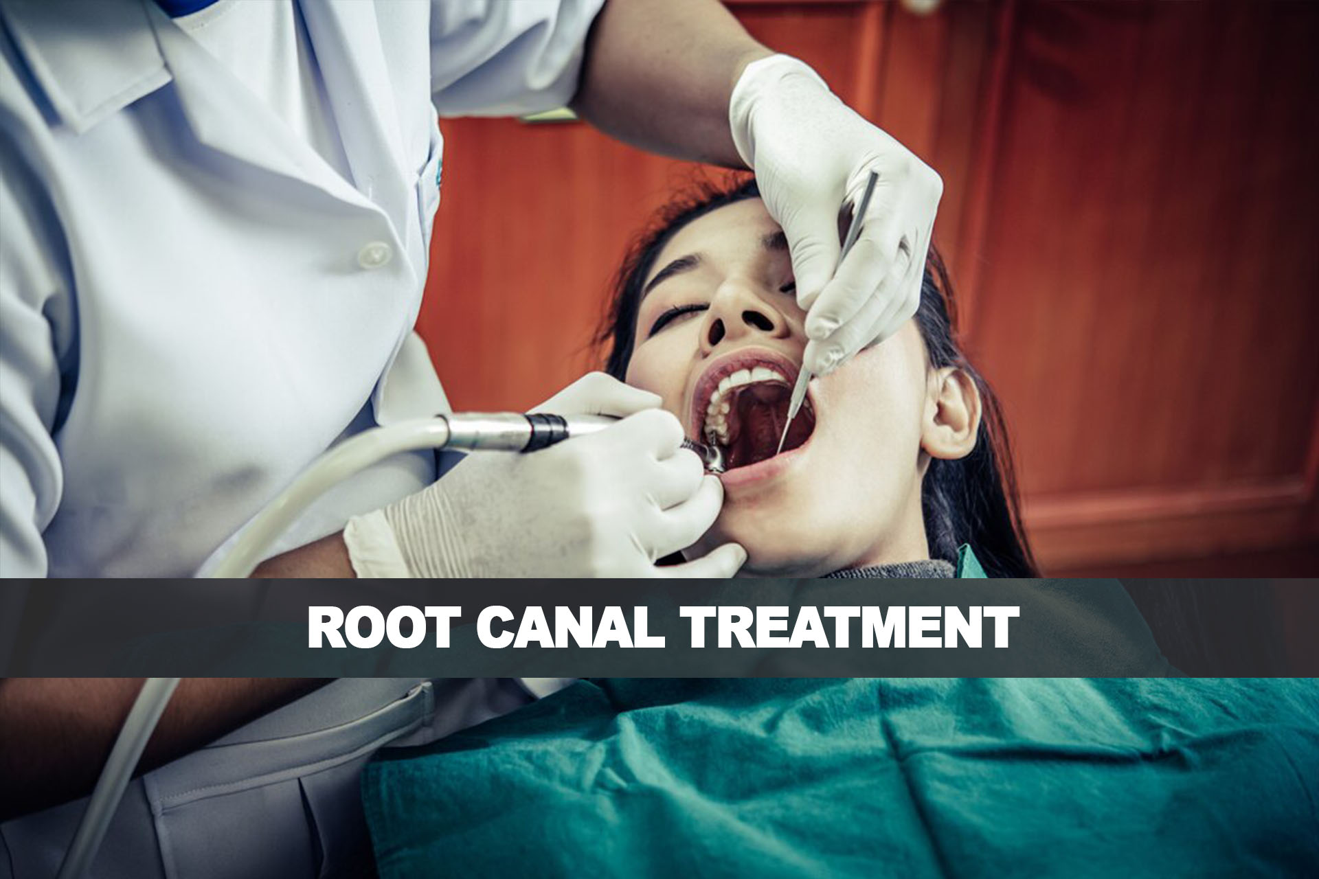 root_canal_treatment_in_malad