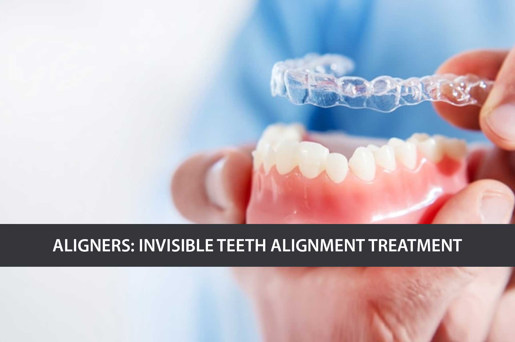 Aligners–Invisible-Teeth-Alignment-Treatment